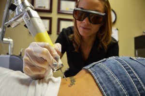 Tattoo Removal at 207 Laser - formerly Maine Laser Clinic