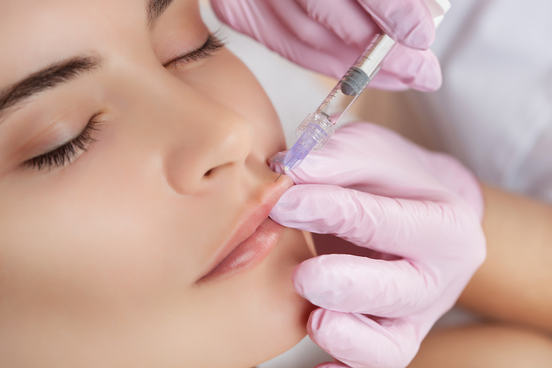 Juvederm
