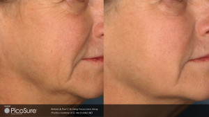 Skin Revitalization