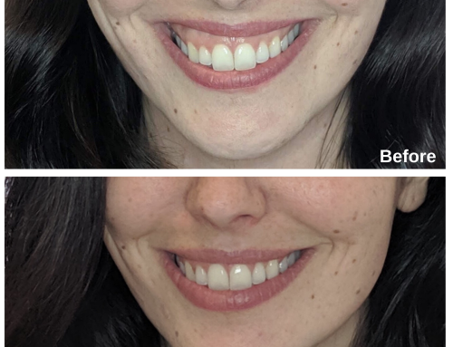 Exciting life-changing ways we can use Botox